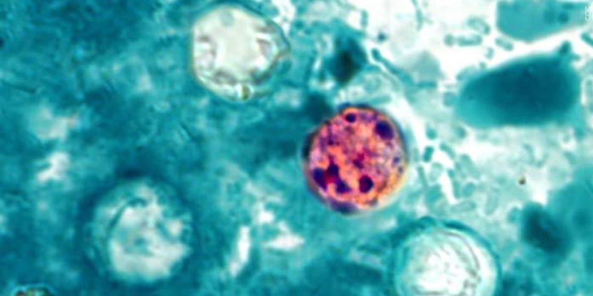 New cyclosporiasis cases reported in Jefferson County