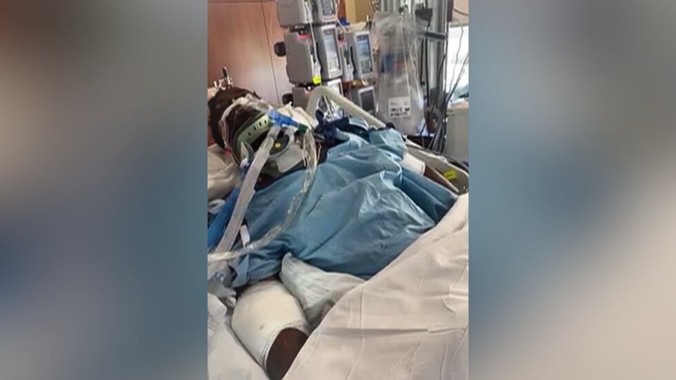Dwayne Washington says he was rushed to the hospital after a police officer's vehicle slammed...